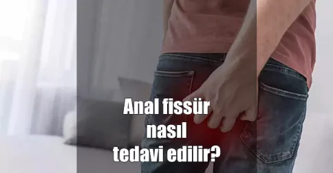 anal fissür tedavisi