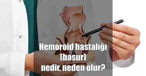 hemoroid basur nedir neden olur